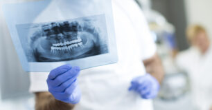 Image of Dentist analyzing an X-ray of teeth