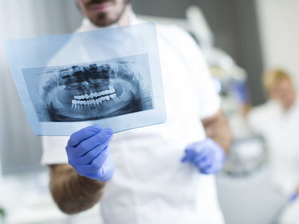 Image of Dentist analyzing an X-ray of teeth